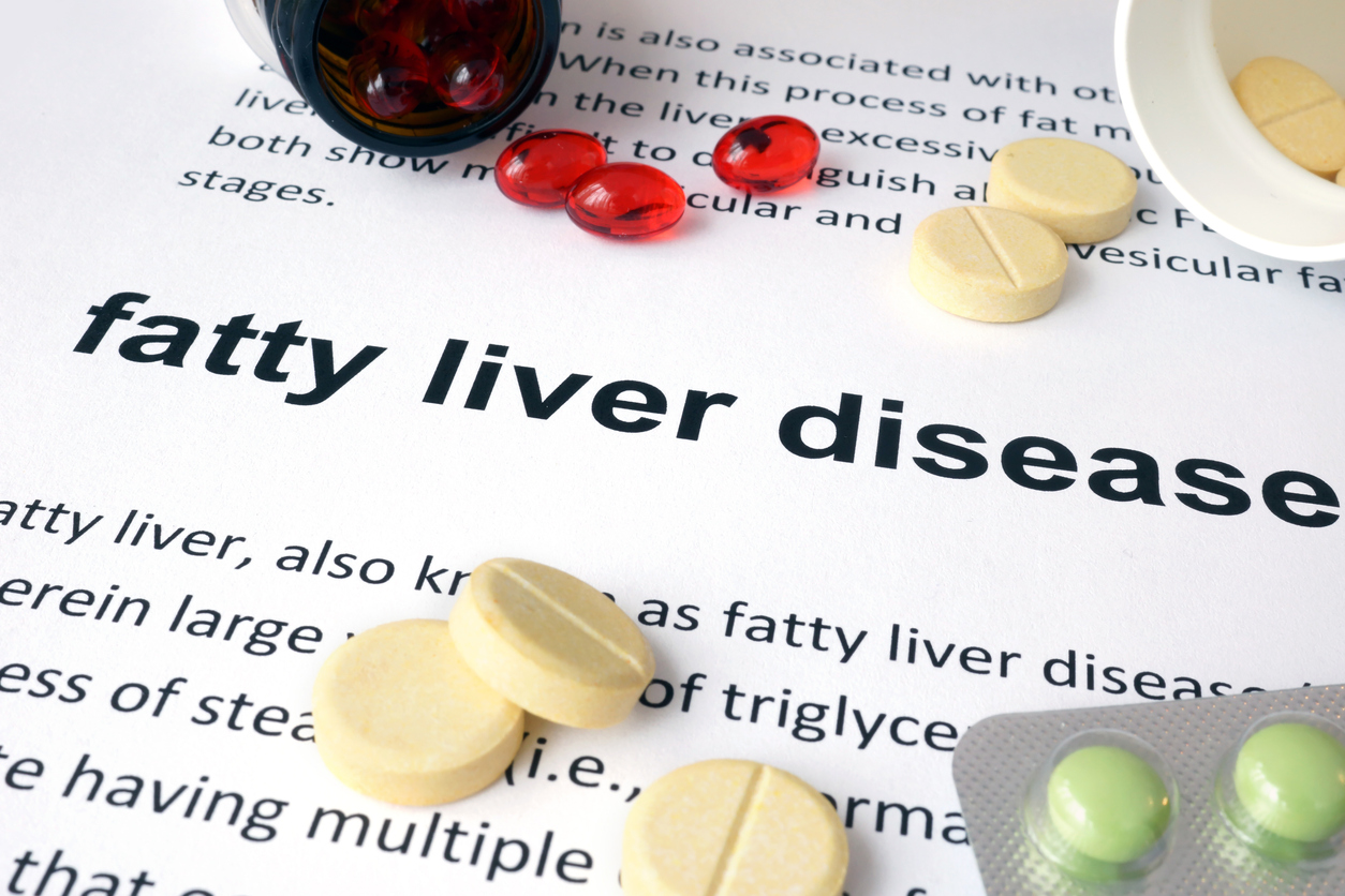 How Weight Loss Can Improve Liver Function LILD