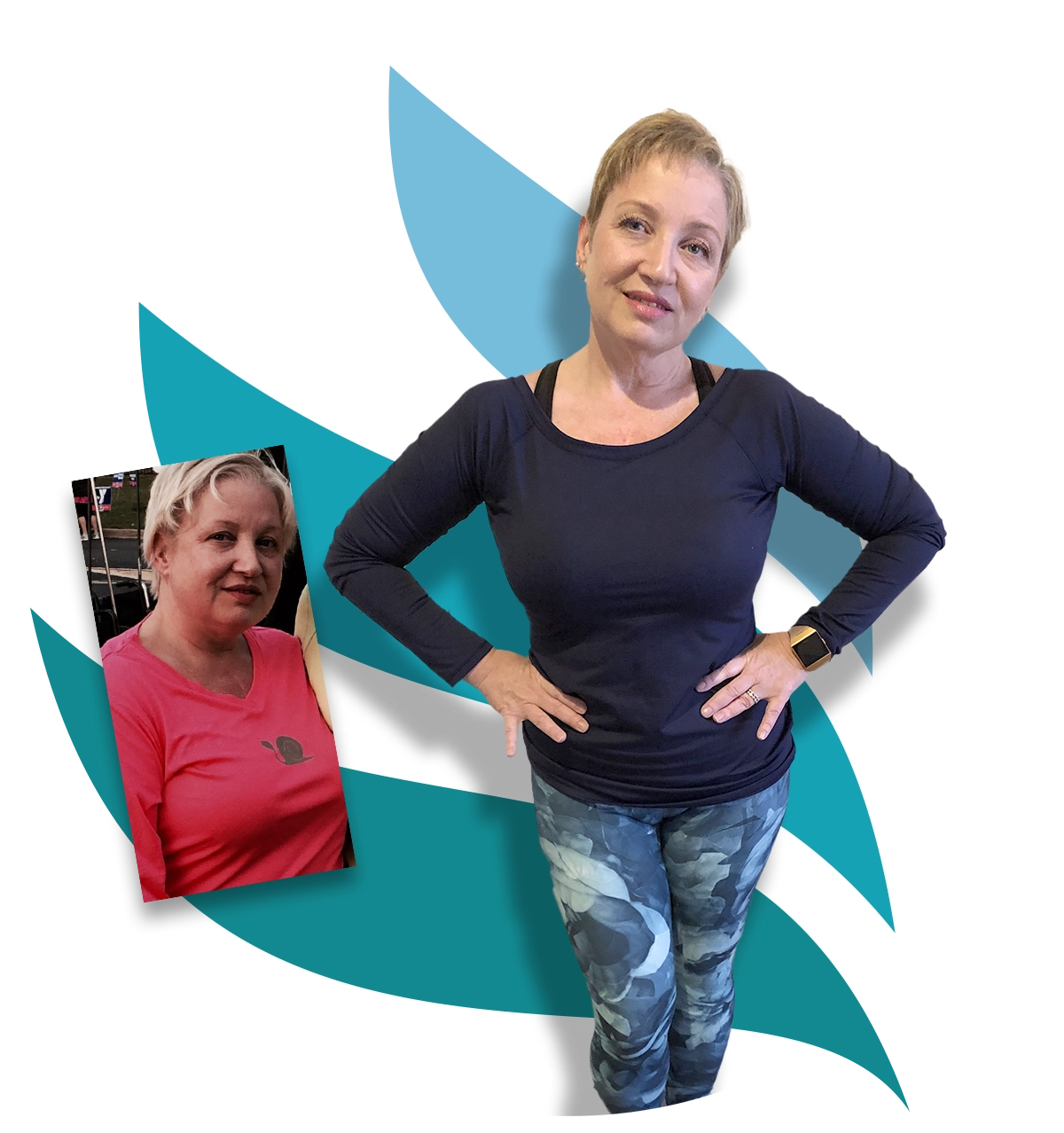 Real Patient Results - Kristina