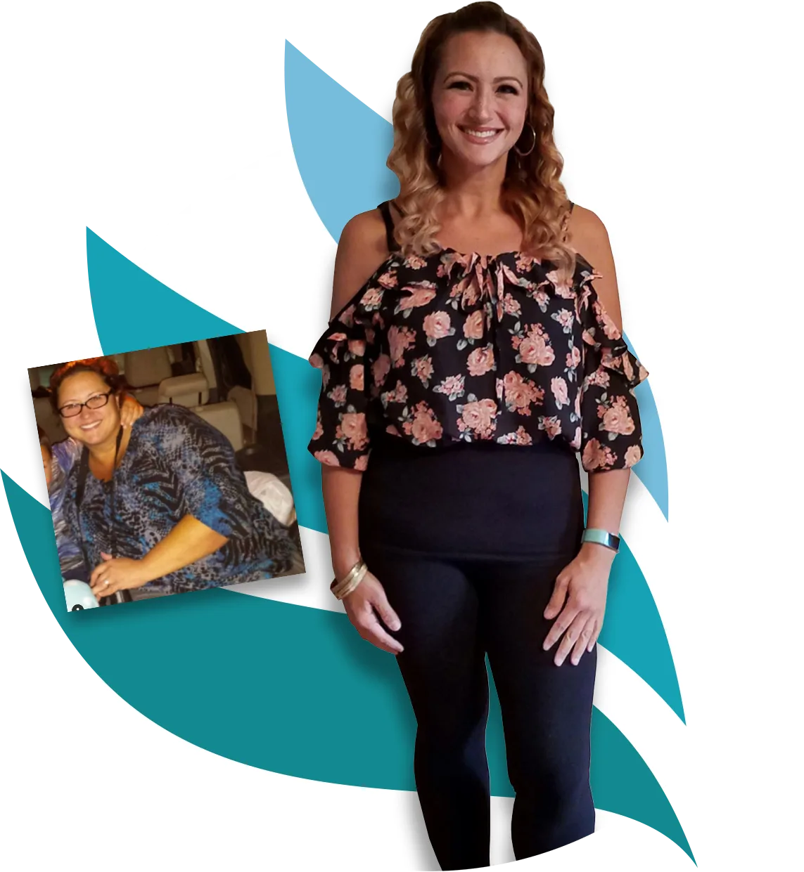 Heather before and after bariatric surgery