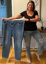 Patient after weight loss surgery