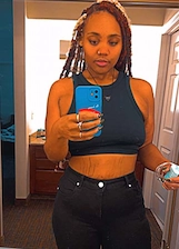 Patient after weight loss surgery