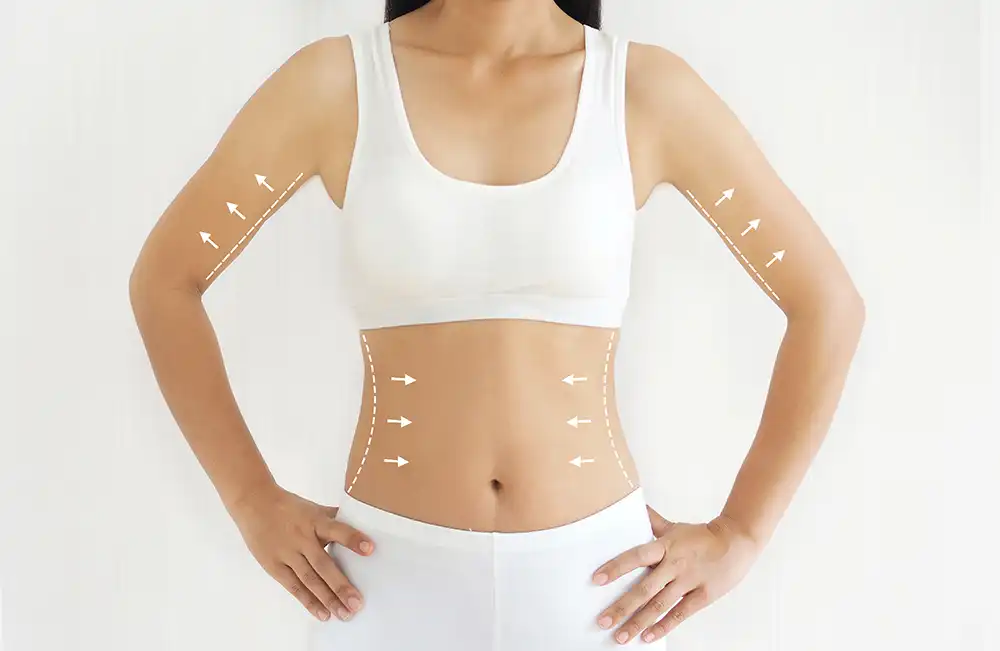 Morpheus8 Body Contouring on beautiful female model