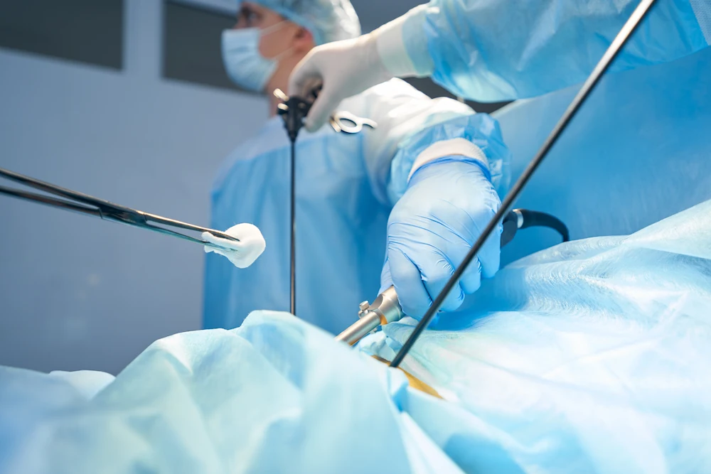 Laparoscopic surgery